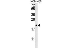 Image no. 3 for anti-Protein tyrosine Phosphatase Type IVA, Member 2 (PTP4A2) antibody (ABIN3002826)