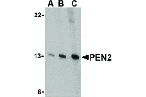 Image no. 1 for anti-Presenilin Enhancer 2 Homolog (PSENEN) (C-Term) antibody (ABIN6657117)