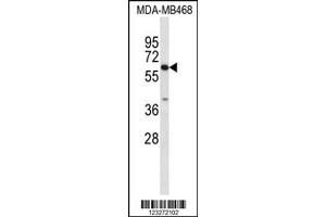 Western Blotting (WB) image for anti-Carboxylesterase 5A (CES5A) antibody (ABIN2158220)
