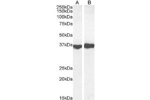 Image no. 5 for anti-Glyceraldehyde-3-Phosphate Dehydrogenase (GAPDH) (Internal Region) antibody (ABIN185543)