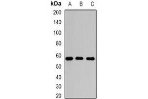 Image no. 1 for anti-N-Sulfoglucosamine Sulfohydrolase (SGSH) (full length) antibody (ABIN6004562)