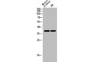 AWAT1 antibody  (C-Term)