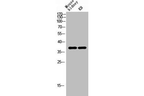 AWAT1 anticorps  (C-Term)