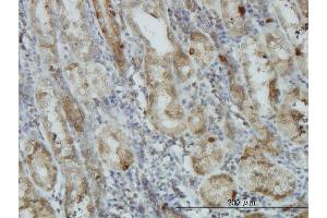 Image no. 4 for anti-V-Akt Murine Thymoma Viral Oncogene Homolog 1 (AKT1) (AA 1-480) antibody (ABIN559829)
