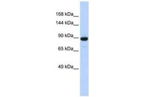 Image no. 1 for anti-phosphodiesterase 3A, cGMP-Inhibited (PDE3A) (AA 360-409) antibody (ABIN6743295)