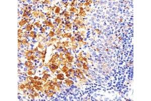 Image no. 2 for anti-FYN Oncogene Related To SRC, FGR, YES (FYN) antibody (ABIN3031012)
