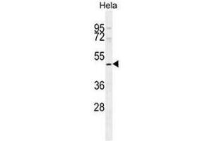 Image no. 2 for anti-SET and MYND Domain Containing 1 (SMYD1) (AA 420-449), (C-Term) antibody (ABIN954865)