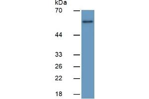 Image no. 4 for Early Growth Response 1 (EGR1) ELISA Kit (ABIN6730895)