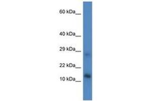 Image no. 1 for anti-LYR Motif Containing 4 (LYRM4) (AA 33-82) antibody (ABIN6746508)
