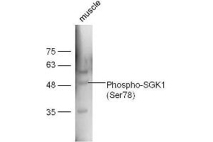 Image no. 3 for anti-serum/glucocorticoid Regulated Kinase 1 (SGK1) (pSer78) antibody (ABIN745688)