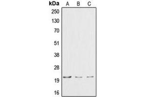 Image no. 2 for anti-Cardiotrophin 1 (CTF1) (N-Term) antibody (ABIN2707388)