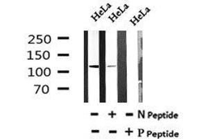 Image no. 4 for anti-Myosin Phosphatase, Target Subunit 1 (PPP1R12A) (pSer299) antibody (ABIN6269625)