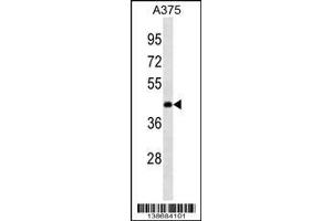 Western Blotting (WB) image for anti-Ankyrin Repeat Domain 63 (ANKRD63) (Center) antibody (ABIN2159128)