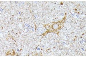 Immunohistochemistry of paraffin-embedded Mouse spinal cord using TBCA Polyclonal Antibody at dilution of 1:100 (40x lens).