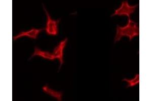Image no. 2 for anti-Macrophage Stimulating 1 (Hepatocyte Growth Factor-Like) (MST1) (C-Term) antibody (ABIN6263402)