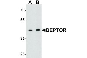 Image no. 2 for anti-DEP Domain Containing mTOR-Interacting Protein (DEPTOR) (Internal Region) antibody (ABIN6656686)