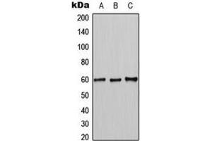 Image no. 2 for anti-MutY Homolog (E. Coli) (MUTYH) (Center) antibody (ABIN2706618)