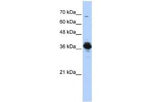 Image no. 1 for anti-ATPase, H+ Transporting, Lysosomal 38kDa, V0 Subunit D2 (ATP6V0D2) (Middle Region) antibody (ABIN630926)