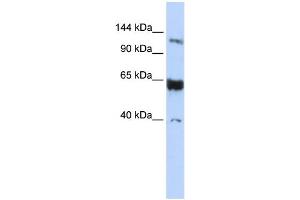 Image no. 1 for anti-Synaptonemal Complex Protein 1 (SYCP1) (N-Term) antibody (ABIN2787639)