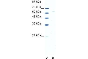Image no. 1 for anti-Forkhead Box N1 (FOXN1) (N-Term) antibody (ABIN2779254)