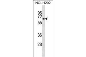 Image no. 1 for anti-Kelch-like protein 41 (KLHL41) (AA 547-575), (C-Term) antibody (ABIN5530208)