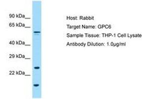 Image no. 1 for anti-Glypican 6 (GPC6) (AA 36-85) antibody (ABIN6749994)