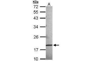 Image no. 2 for anti-Anterior Gradient 3 (AGR3) (Center) antibody (ABIN2856645)