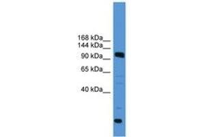 Image no. 1 for anti-Ubiquitin Specific Peptidase 15 (USP15) (AA 691-740) antibody (ABIN6745393)
