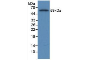 Image no. 1 for anti-Fibrinogen beta Chain (FGB) antibody (ABIN5983274)