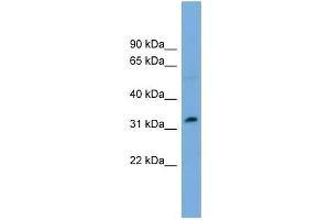 Image no. 2 for anti-PHD Finger Protein 13 (PHF13) (Middle Region) antibody (ABIN2784470)