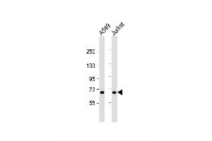 Image no. 2 for anti-Coagulation Factor XI (F11) (AA 281-307) antibody (ABIN655515)