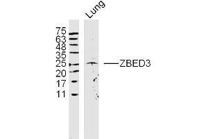 Rat lung lysates probed with ZBED3 Polyclonal Antibody, Unconjugated  at 1:300 dilution and 4˚C overnight incubation.