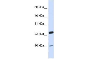 Image no. 1 for anti-TAF13 RNA Polymerase II, TATA Box Binding Protein (TBP)-Associated Factor, 18kDa (TAF13) (N-Term) antibody (ABIN928173)