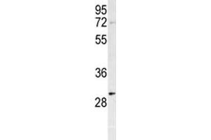 Image no. 2 for anti-Prohibitin (PHB) (AA 89-117) antibody (ABIN3032316)