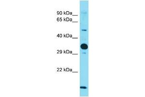 Image no. 1 for anti-Nogo B Receptor (NUS1) (Middle Region) antibody (ABIN2790565)