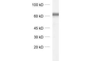 dilution: 1 : 1000, sample: synaptic membrane fraction (LP1) of rat brain