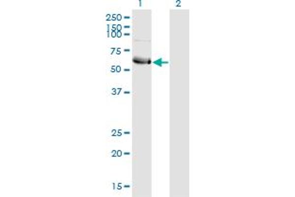 anti-Heat Shock Transcription Factor, Y-Linked 1 (HSFY1) (AA 1-99) antibody