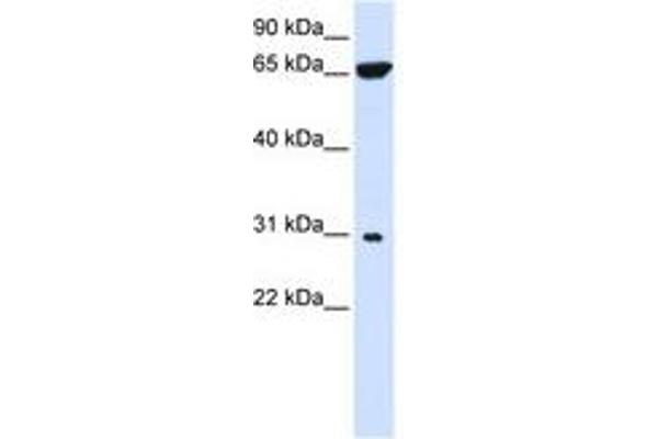 PTPLAD2 抗体  (AA 72-121)