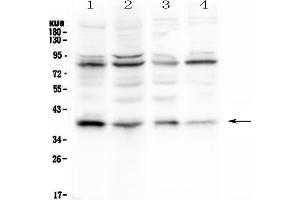 Image no. 5 for anti-Nuclear Factor of kappa Light Polypeptide Gene Enhancer in B-Cells Inhibitor, alpha (NFKBIA) (AA 3-112) antibody (ABIN3043889)