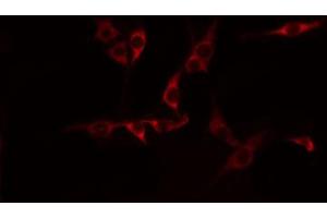 Image no. 3 for anti-M-Cadherin (CDH15) (N-Term) antibody (ABIN6257758)