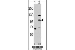 Image no. 2 for anti-Mitogen-Activated Protein Kinase Kinase Kinase MLK4 (KIAA1804) (AA 33-62), (N-Term) antibody (ABIN392542)
