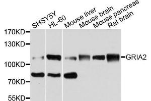 Image no. 2 for anti-Met Proto-Oncogene (MET) antibody (ABIN1873686)