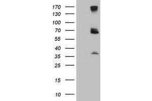 Image no. 3 for anti-Proteasome (Prosome, Macropain) 26S Subunit, Non-ATPase, 3 (PSMD3) antibody (ABIN1499980)