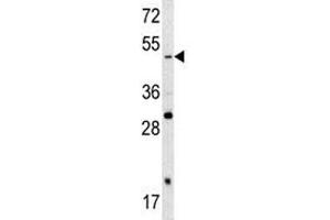 SOX4 anticorps  (AA 86-114)