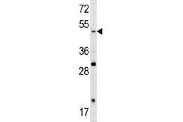 SOX4 anticorps  (AA 86-114)