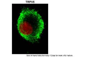 Image no. 2 for anti-Transient Receptor Potential Cation Channel, Subfamily V, Member 5 (TRPV5) (N-Term) antibody (ABIN2783755)