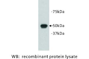 Image no. 1 for anti-FAT Tumor Suppressor Homolog 1 (FAT1) antibody (ABIN1112925)