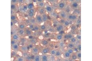 Image no. 3 for anti-Glutathione S-Transferase mu 2 (Muscle) (GSTM2) (AA 1-218) antibody (ABIN1078085)