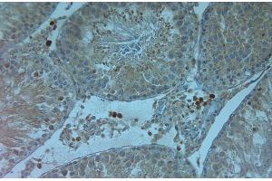 IHC on paraffin sections of rat testis tissue using Rabbit antibody to TRPV4: .