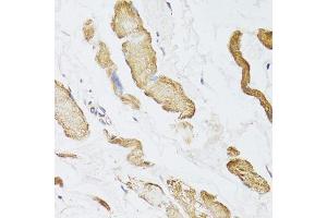 Image no. 2 for anti-Creatine Kinase, Mitochondrial 2 (Sarcomeric) (CKMT2) antibody (ABIN6138655)